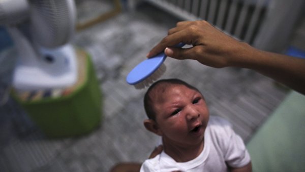 Ребенок больной микроцефалией в городе Ресифе Бразилия