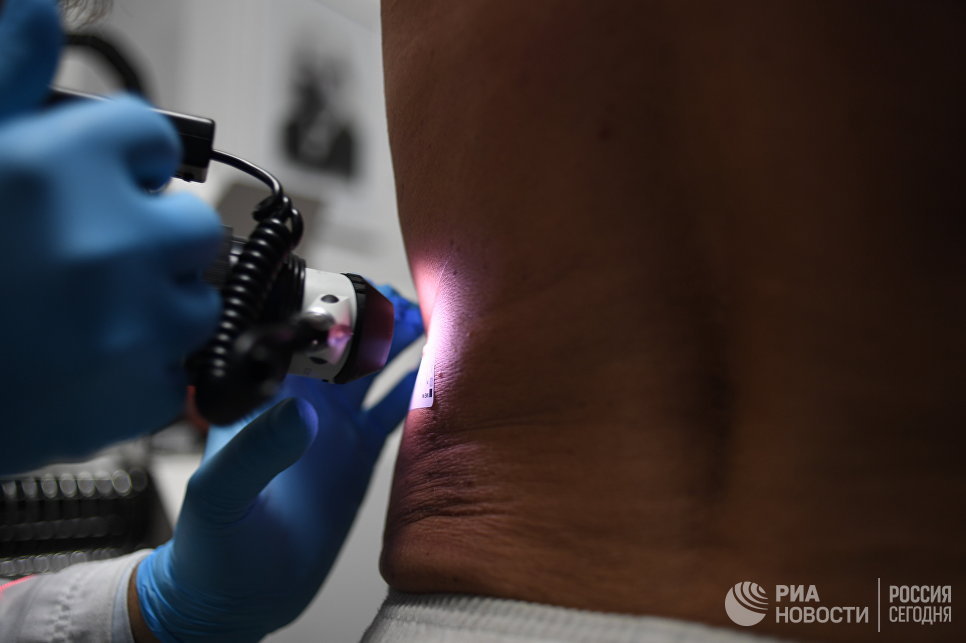 Папилломы под мышками причины и лечение народными средствами