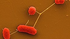 Энтерогеморрагическая бактерия Escherichia coli (EHEC) под микроскопом Энтерогеморрагическая бактерия Escherichia coli (EHEC) под микроскопом